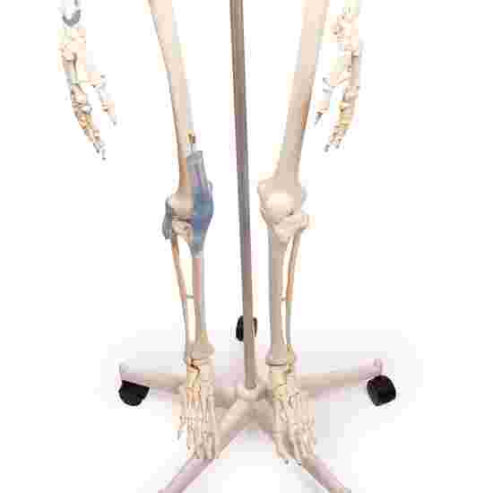 Erler Zimmer Skeletmodel &quot;Skelett Otto mit Bandapparat&quot;